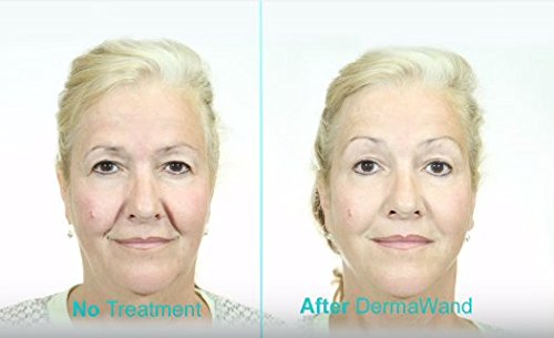 DERMAWAND ANTI-AGING SYSTEM 2